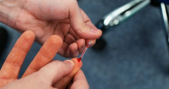 Dwa proste triki na kontrolę cukrzycy, które nabierają mocy w pandemii