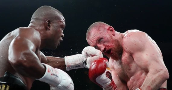Boks. Makabu po kontrolnym ważeniu przed obroną pasa WBC