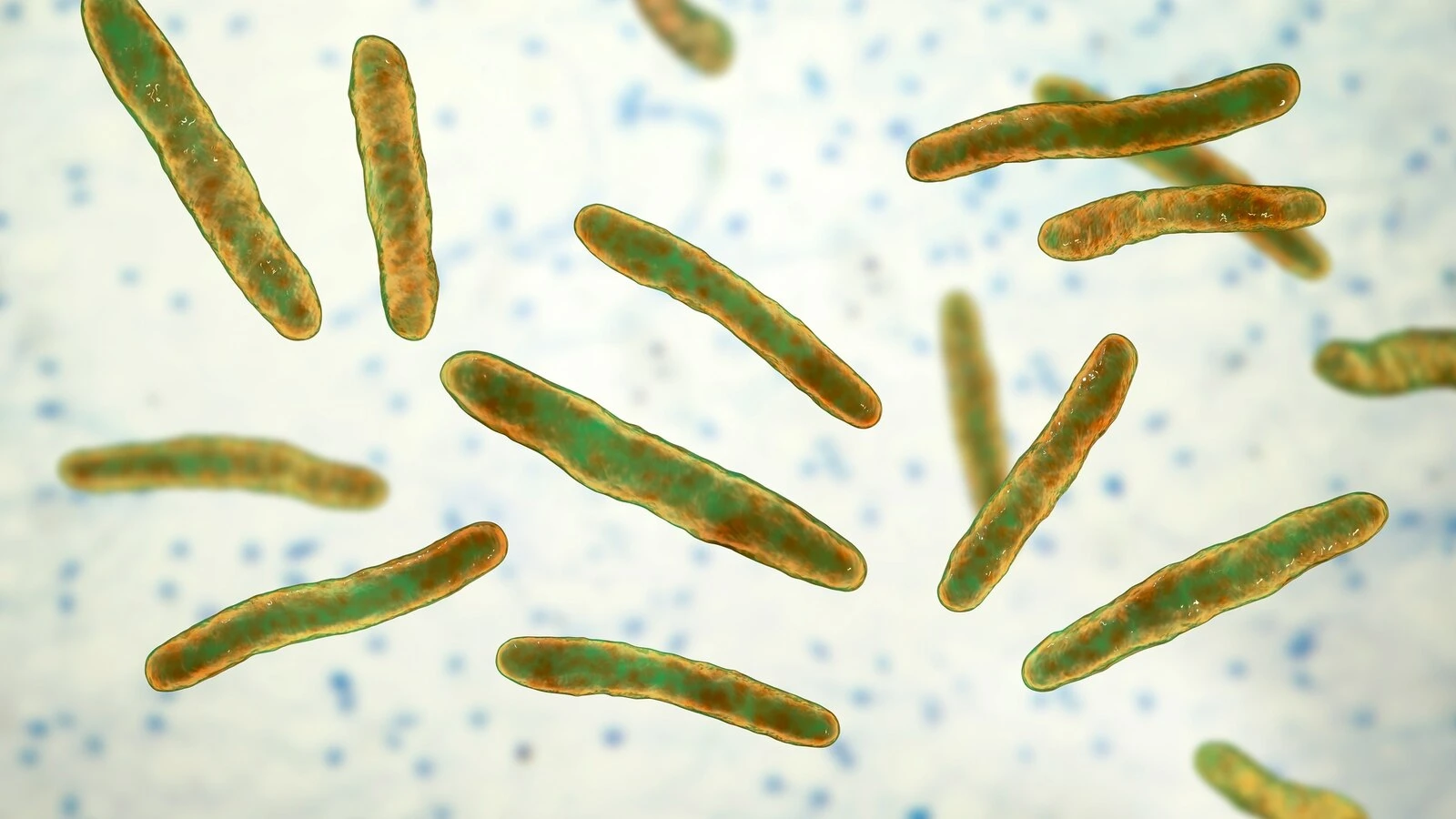 Case of tuberculosis confirmed at high school in this state, officials sayIt's unclear if the patient is a student, faculty member or staff member.1 minute ago