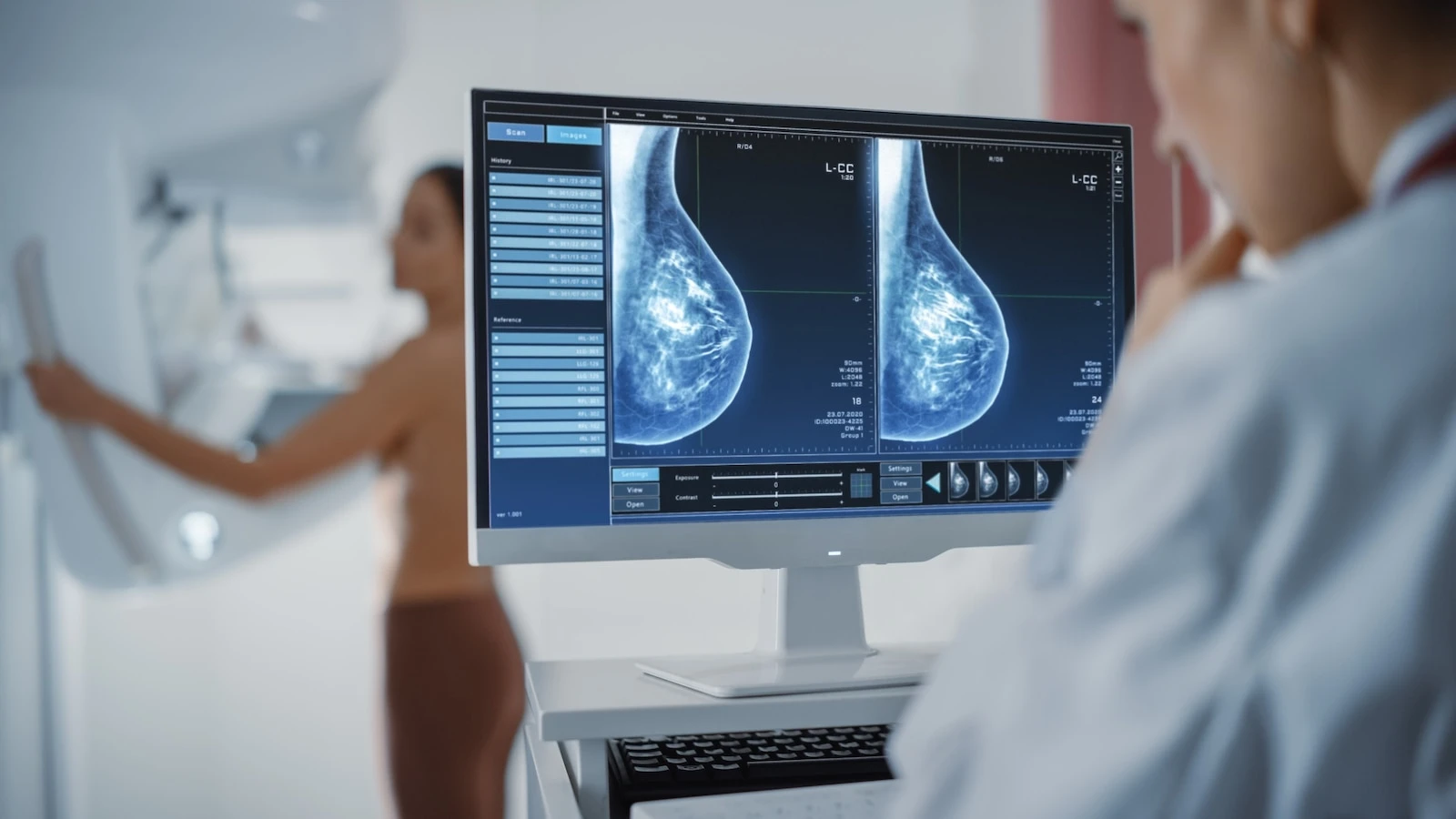 New guidance drops breast cancer screening age to 40 for women with average risk Prior USPSTF recommendations said women should start screening at age 50.4/30/2024 11:02:00 EDT