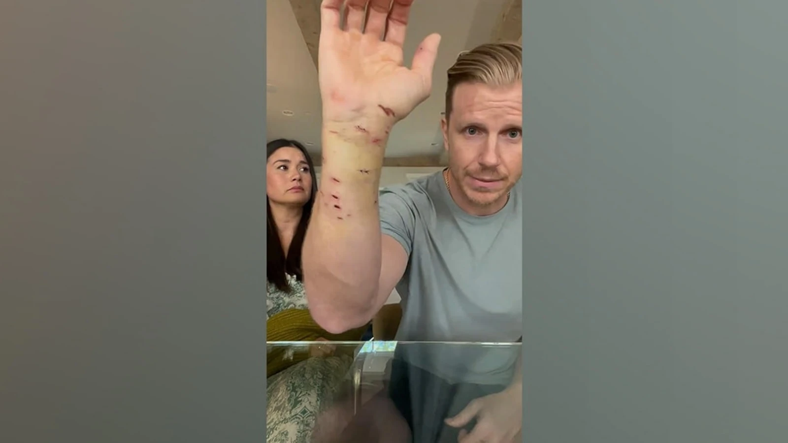'Bachelor' alum Sean Lowe details injuries after attack by rescue dog: 'We're torn'