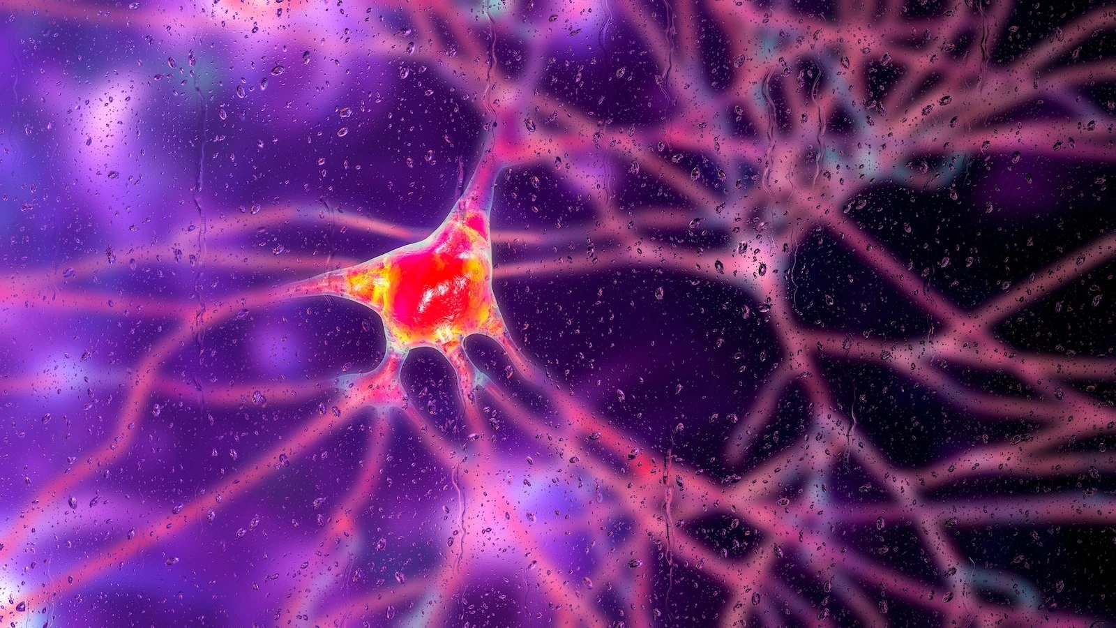 Breakthrough gene therapy shows 75% reduction in Huntington's disease progression