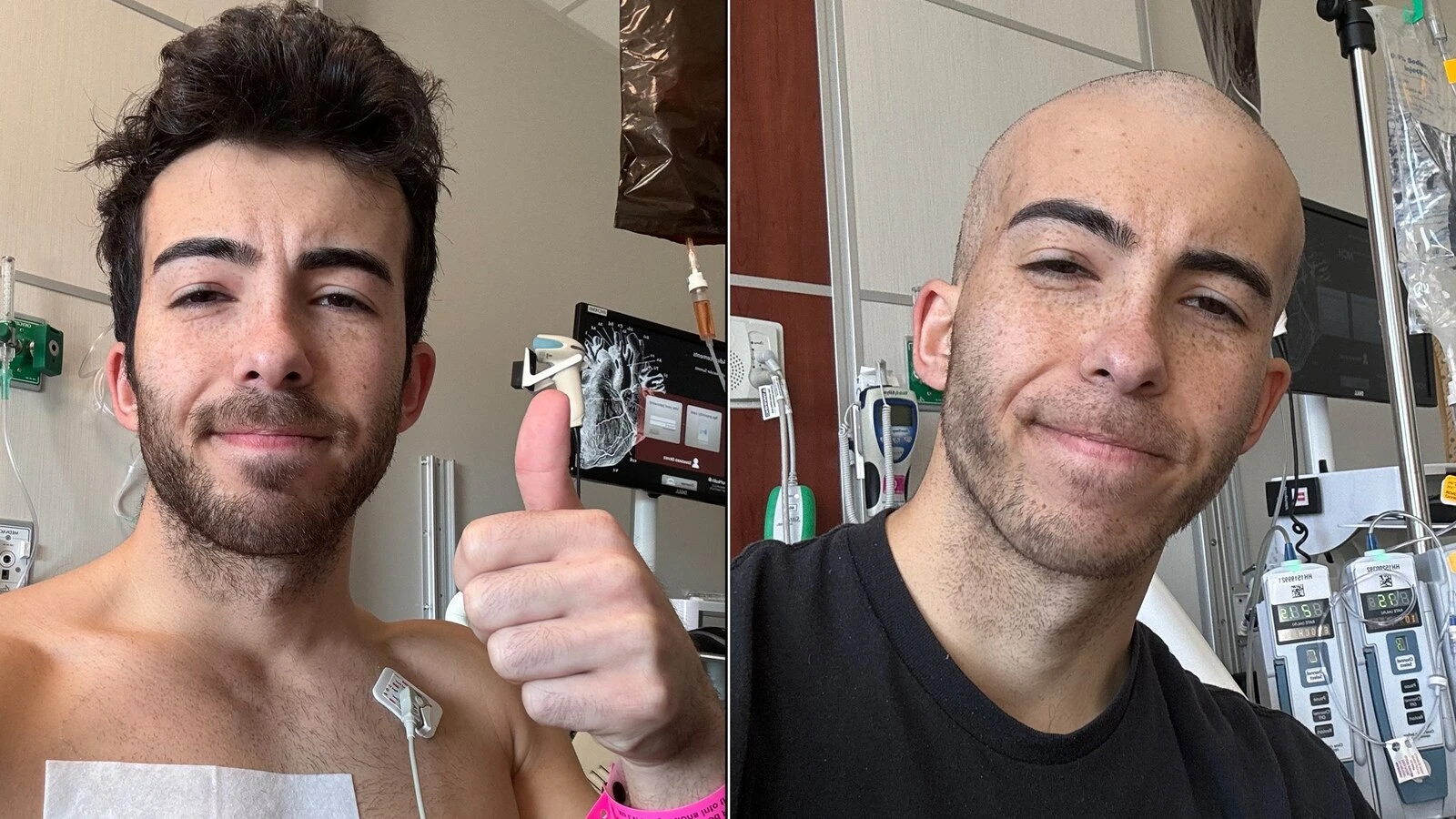 25-year-old diagnosed with cancer shares his journey on social media to help othersJace was diagnosed with non-Hodgkin lymphoma in January. 3/13/2024 04:04:33 EDT