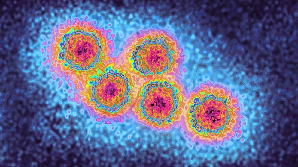 Mass. officials report cluster of hepatitis A cases, resembling 2018 outbreak