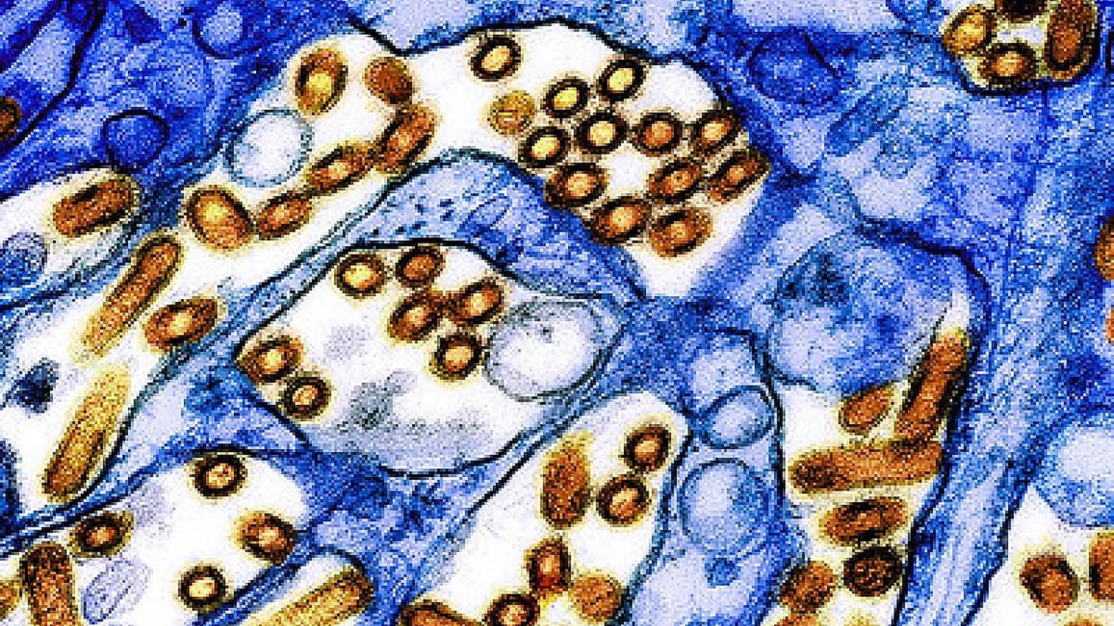 WHO launches initiative to develop mRNA vaccines against bird flu