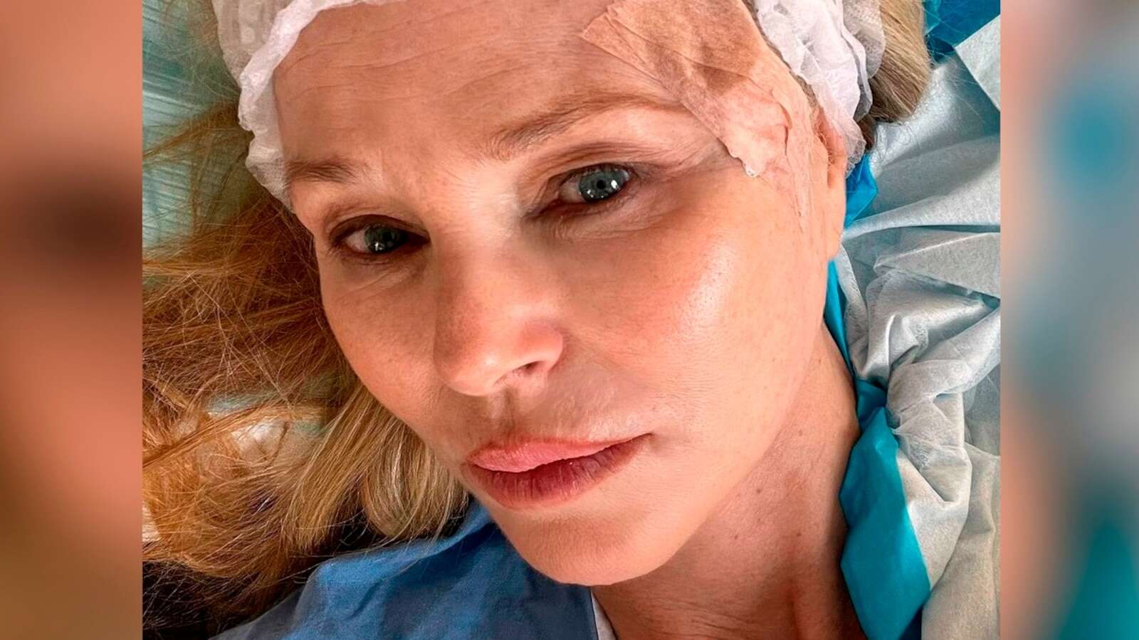 Christie Brinkley reveals she had surgery to remove skin cancerBrinkley said the 