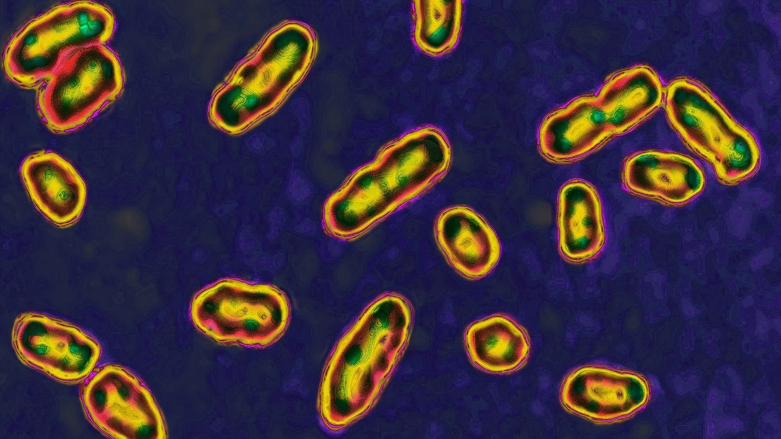 New Mexico man diagnosed with plague in state's 1st human case this year