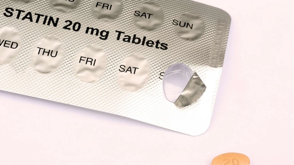 More than 40% of US adults are unaware they have high cholesterol and are untreated