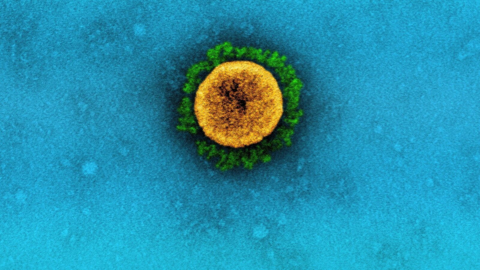 Why are more than 300 people in the US still dying from COVID every week?