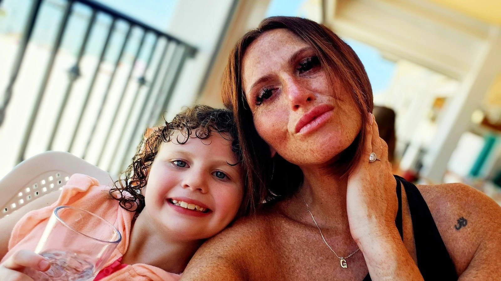 Mom shares warning after nearly losing life to flesh-eating bacteria infection