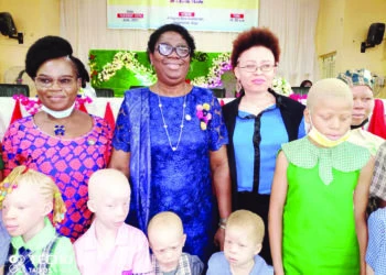 Lagos celebrates albinos