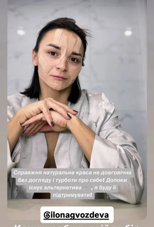 36-річна Ілона Гвоздьова показала, як омолоджує обличчя без ботоксу