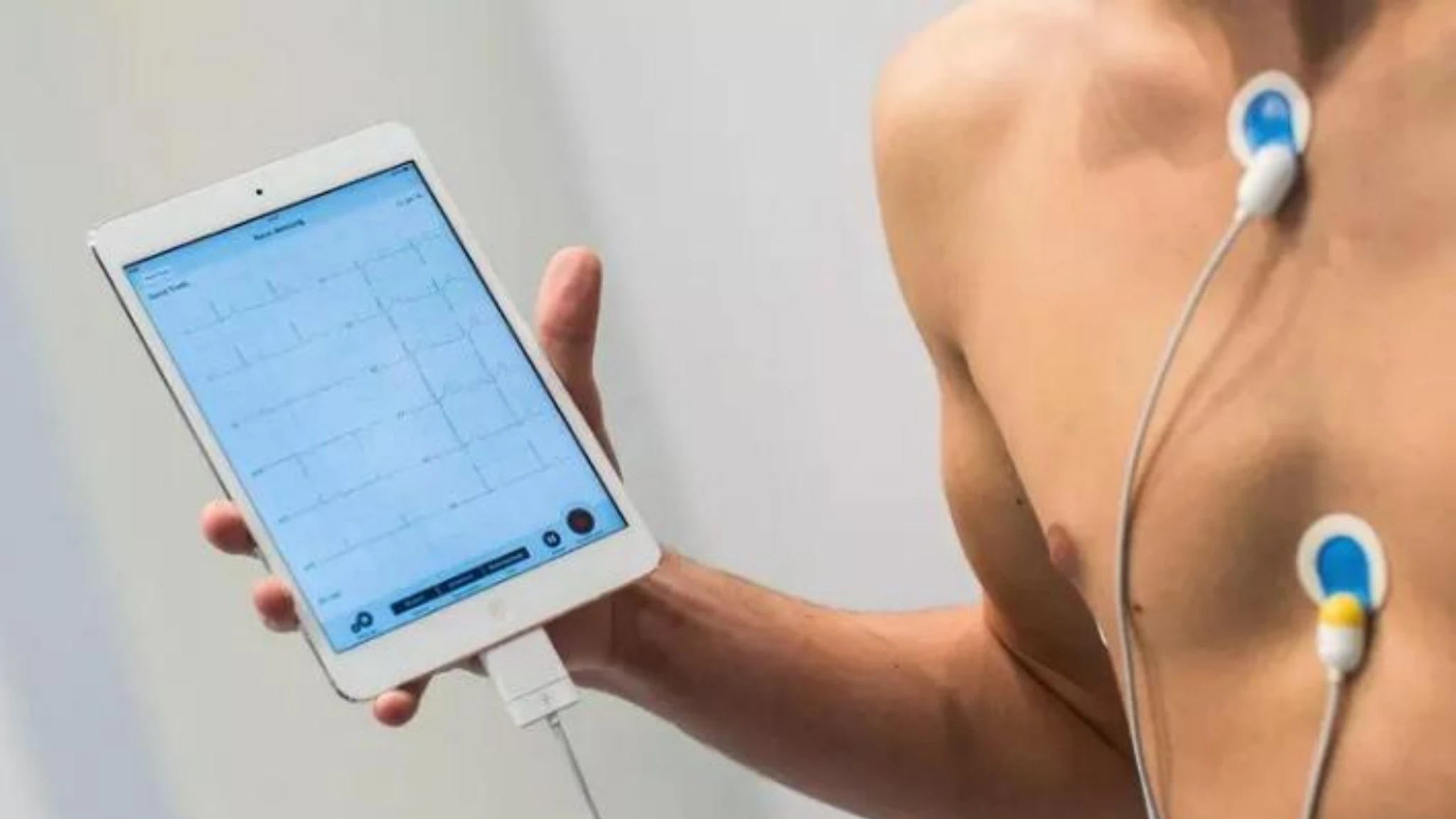 Arresto cardiaco improvviso nei giovani, dna e cicatrici cuore le cause finora ignote 