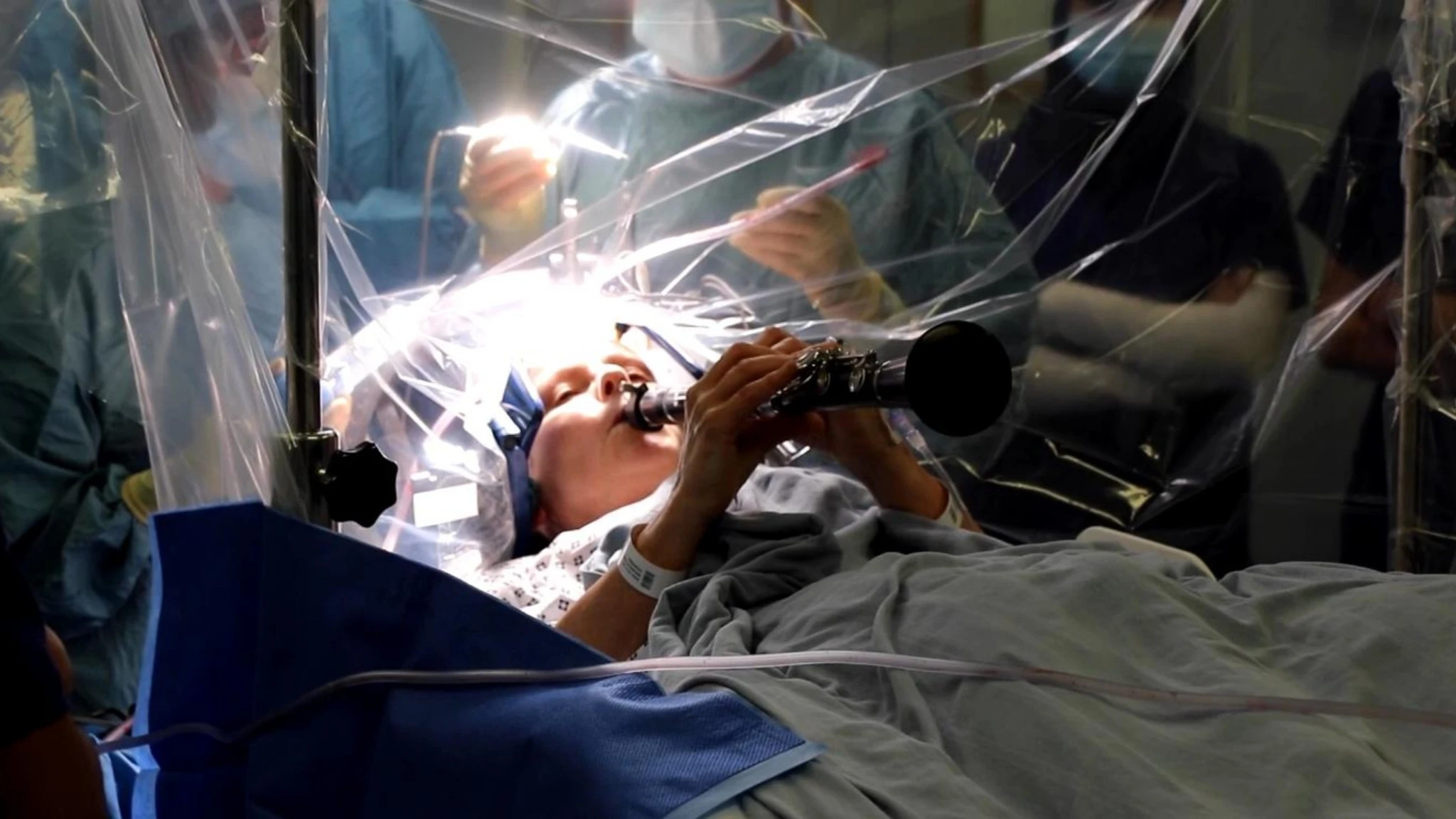 Operata al cervello per Parkinson, Denise suona il clarinetto durante l'intervento: 