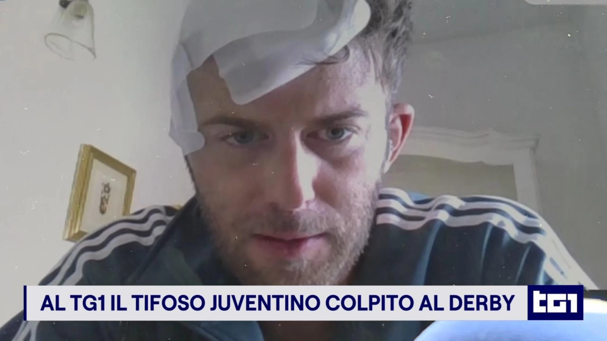 Il tifoso juventino colpito al derby: 