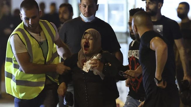 Aktris Terkenal Palestina Ditembak Polisi Saat Ikut Demo Melawan Israel