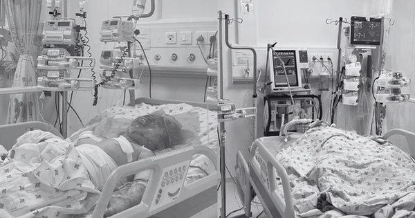 Hai chị em nguy kịch do cha ruột phóng hỏa đốt phòng trọ
