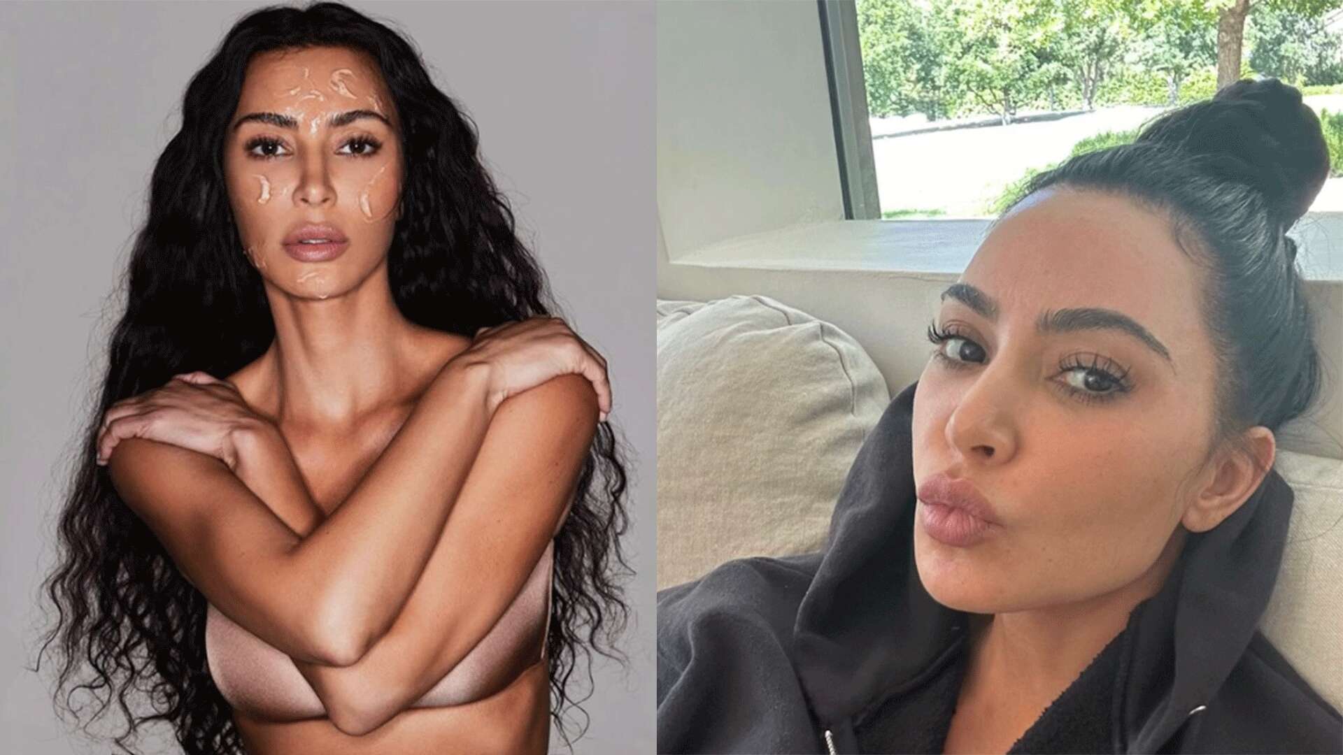 Kim Kardashian racconta la sua acne in età adulta: “l’ho documentata, nessuno se lo aspetterebbe”