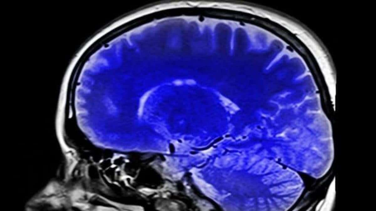 Il cambiamento climatico riduce le dimensioni del nostro cervello, secondo un nuovo studio