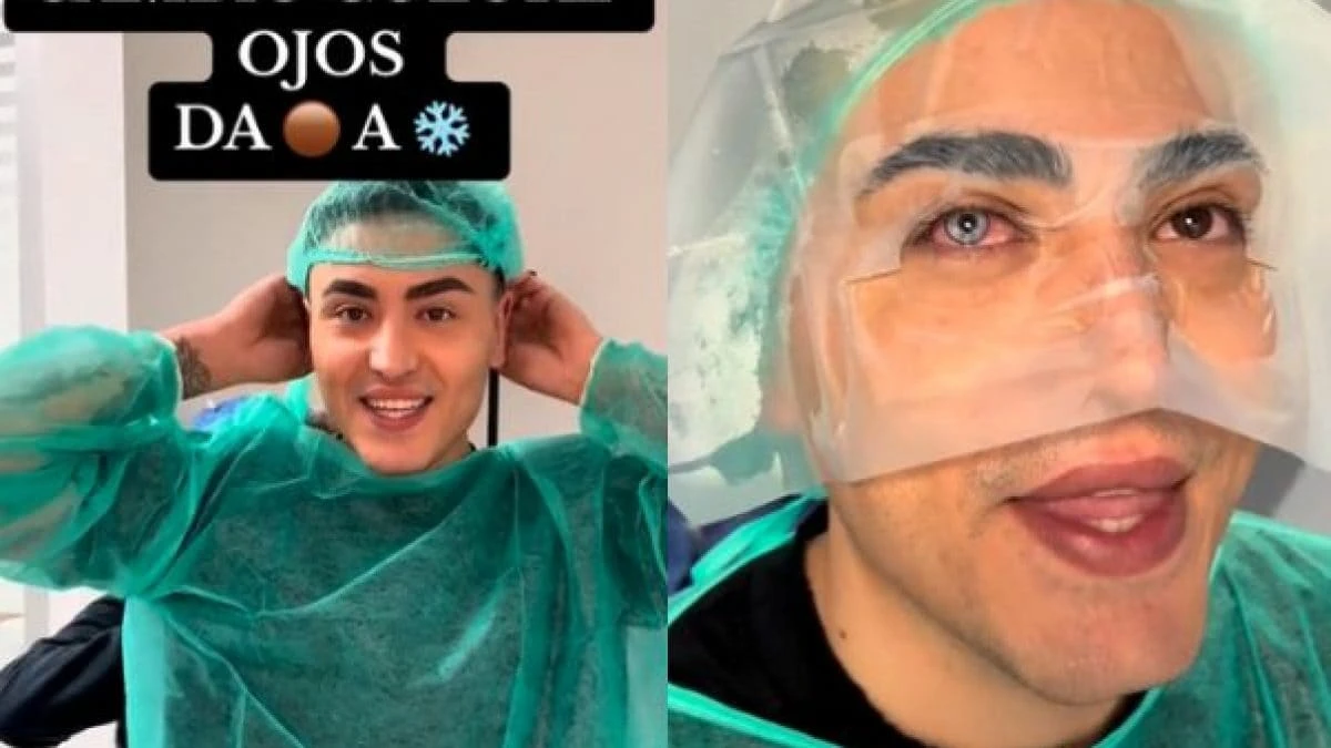 Un tiktoker italiano si è fatto cambiare il colore degli occhi: come funziona l’operazione