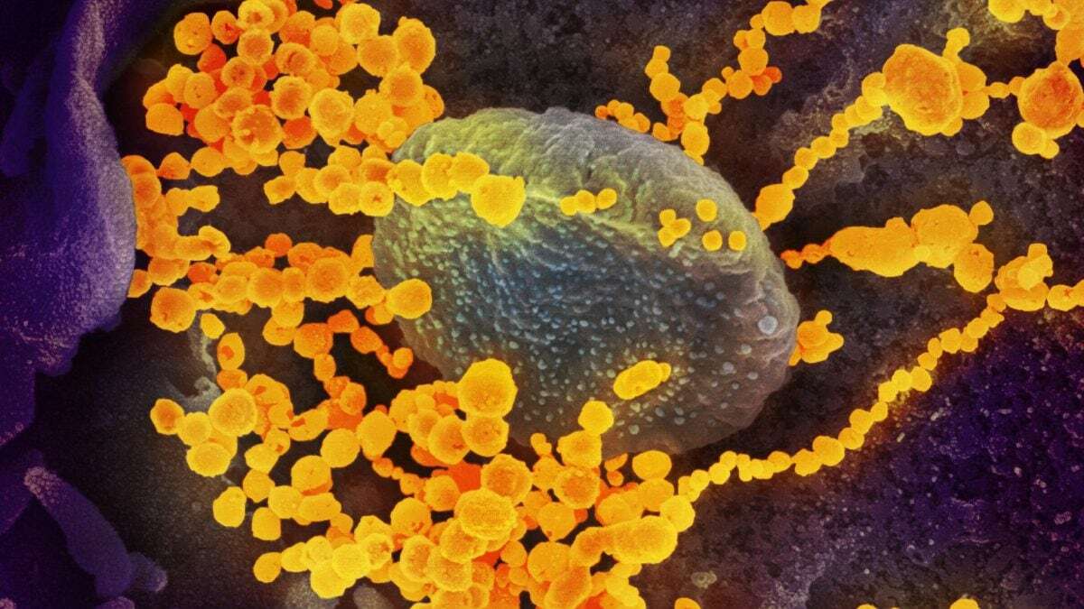 Covid, qual è la variante del coronavirus che deve preoccuparci di più per l’autunno