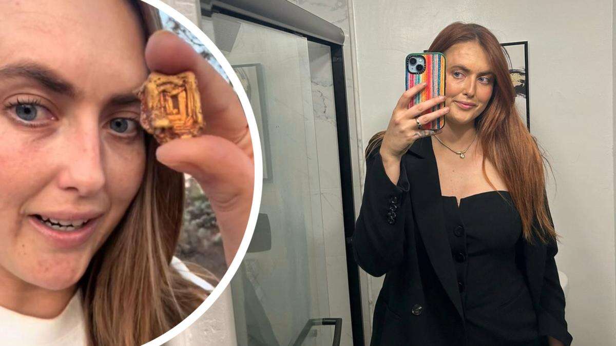 WA woman comes across one of ‘world’s rarest gold nuggets’