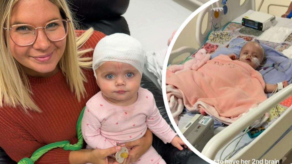 Mum shares heartbreaking footage after baby’s brain surgery