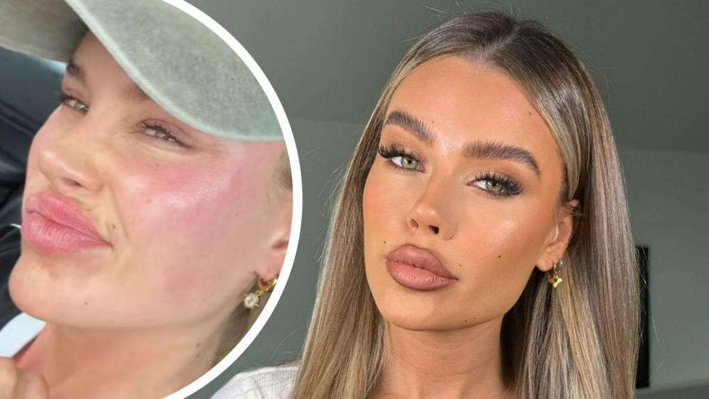 Skye Wheatley reveals dramatic new look under her bandages