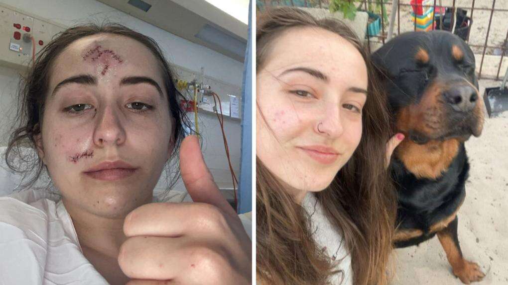 Perth Now exclusive‘A lot of blood’: Young Perth woman mauled by friend’s dog