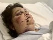 Alleged church grandma basher faces court