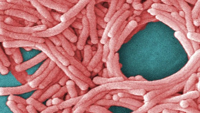 One dead after legionnaires’ outbreak