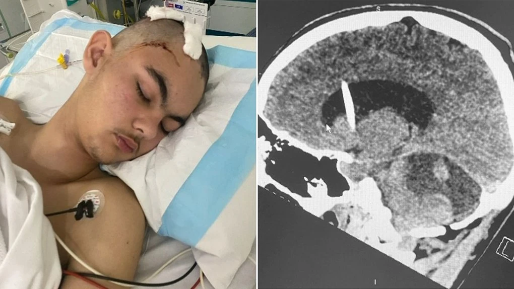 The life-saving discovery made after teen’s ‘lucky’ head knock
