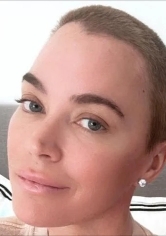 Teddi Mellencamp finally seeing ‘real change’ in her hair growth following months of cancer treatment
