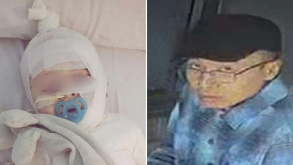 breakingPolice confirm fears about man who scalded baby with coffee