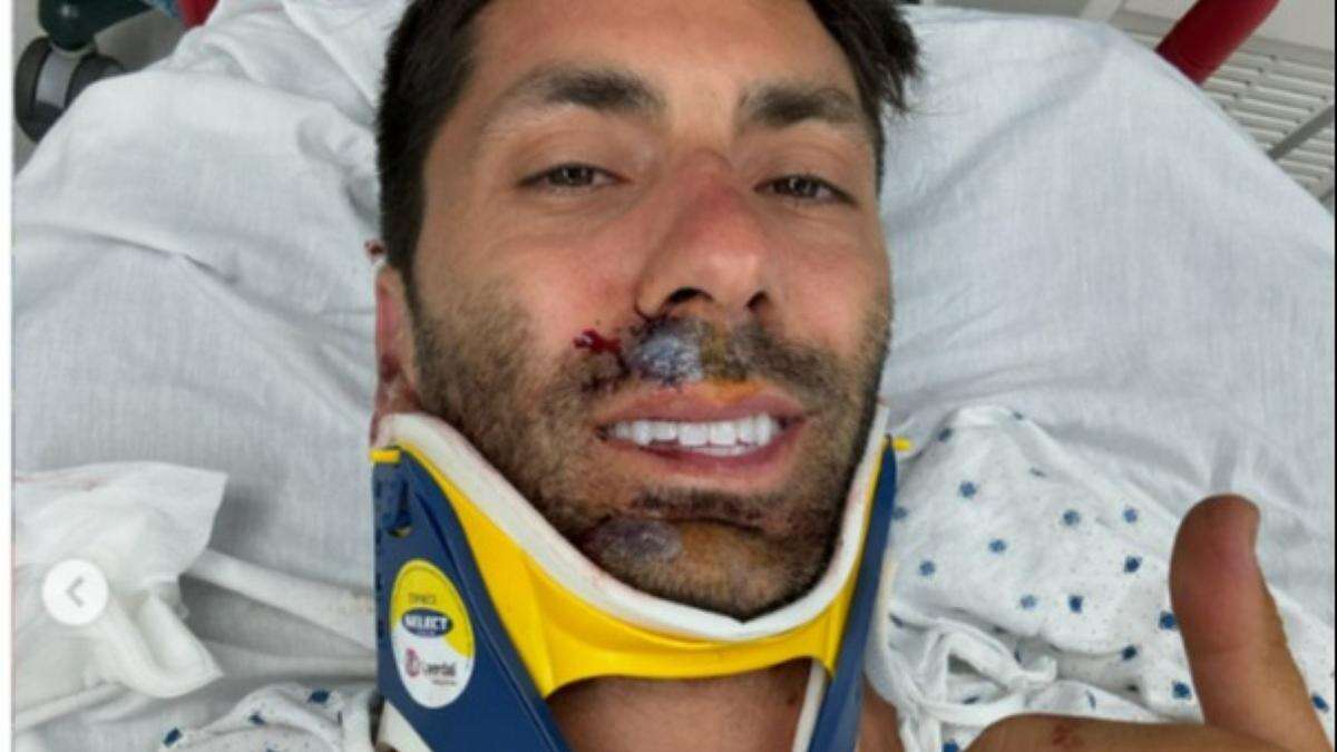 Nev Schulman back on his feet after breaking his neck