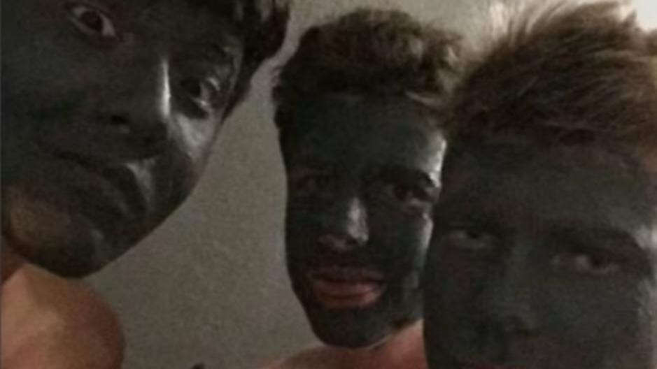 Their school booted them for ‘blackface. It was an acne mask