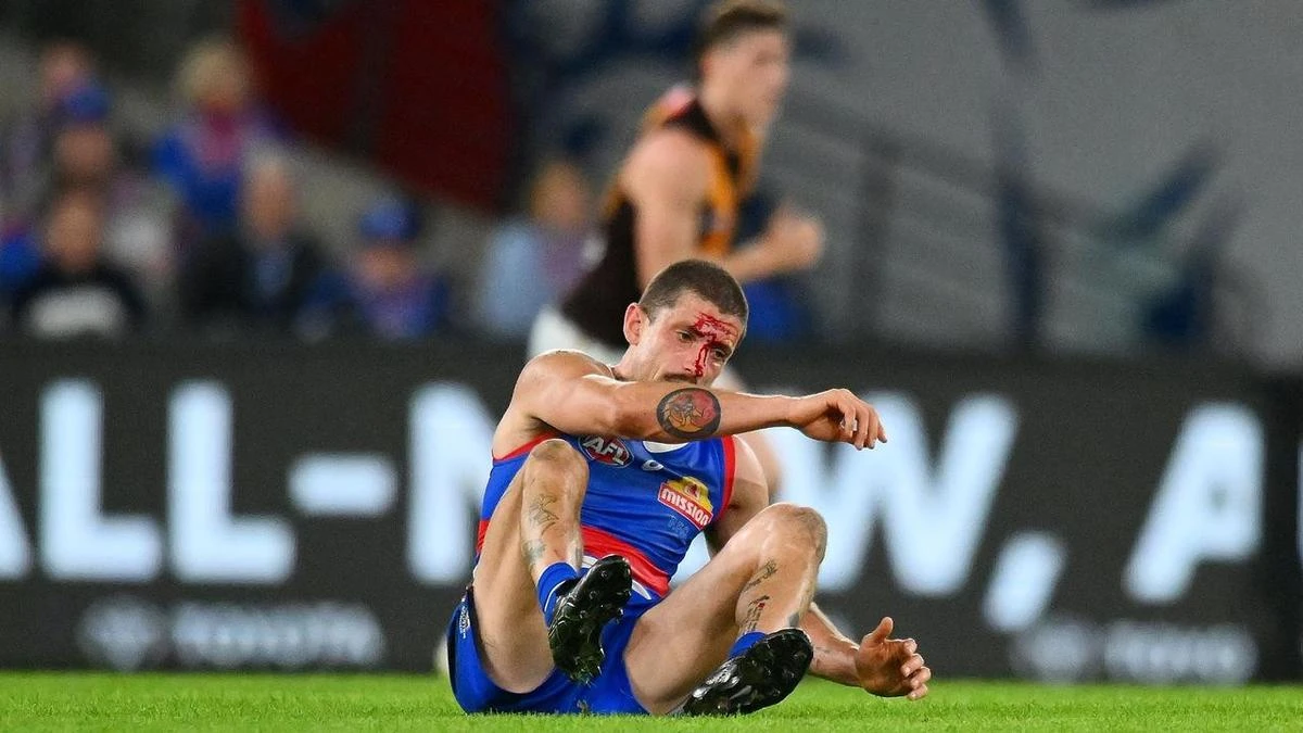No answers on Bulldog Liberatore's future yet