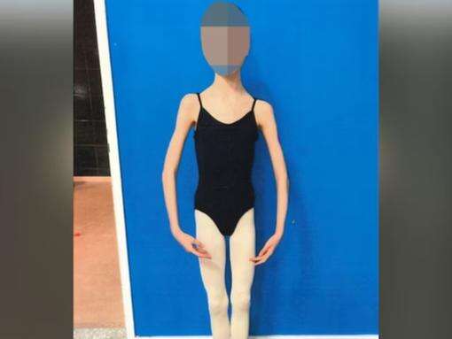 Parents’ horror act to ballerina child