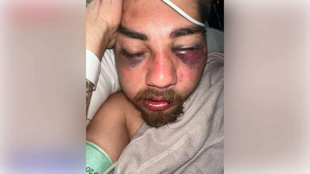 Brutal assault leaves man with serious injuries