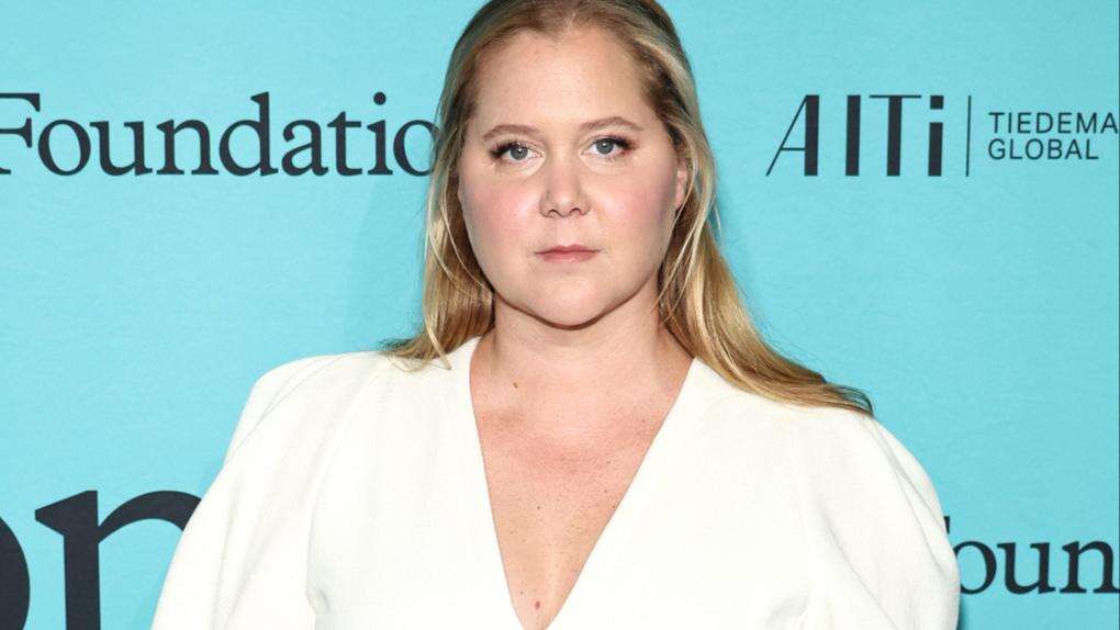 Amy Schumer: Trolls prompted my Cushing syndrome diagnosis