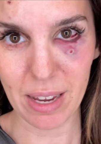 Disney star Christy Carlson Romano shot and rushed to hospital 'I'm just grateful to be alive...'