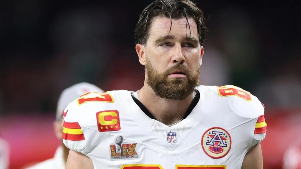 Has Travis Kelce had a hair transplant?