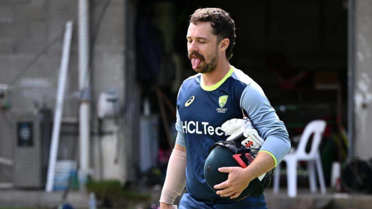 Australia star Head needs to prove fitness for MCG Test