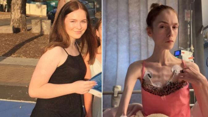 Aussie teen suffering from anorexia speaks out over ‘traumatic’ treatment options