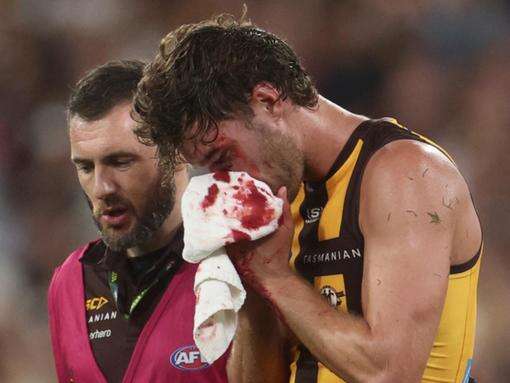 Hawk Scrimshaw dealt three-match ban for Ridley hit