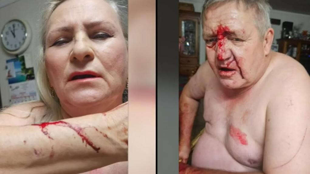 ‘Ninja’ with throwing star attacks grandma in Perth’s south