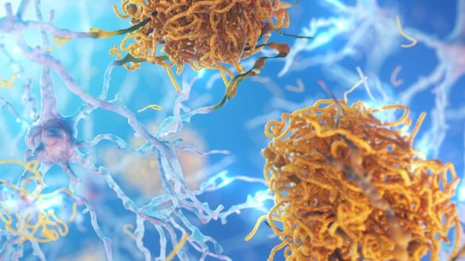 ‘Hope’: Huge leap in dementia treatment