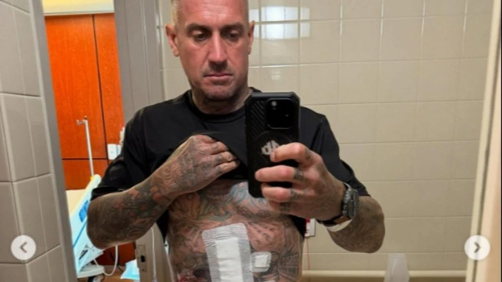Carey Hart injured in motocross training accident