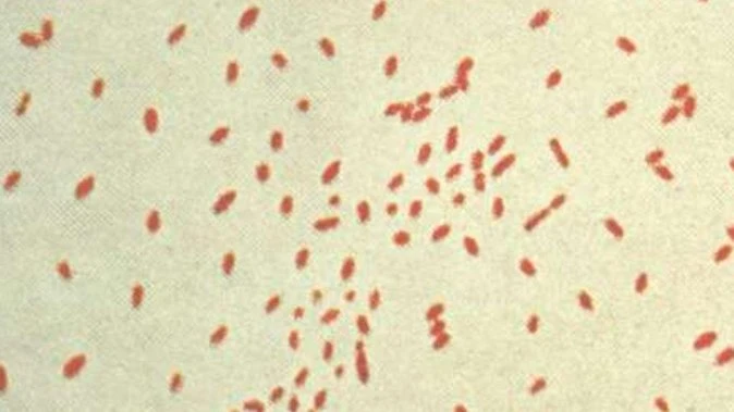State hit by record outbreak of deadly virus