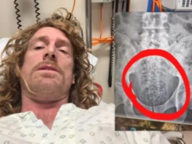 Aussie prankster rushed to hospital after joke goes wrong